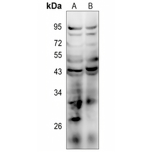 AT2 Rabbit Polyclonal Antibody