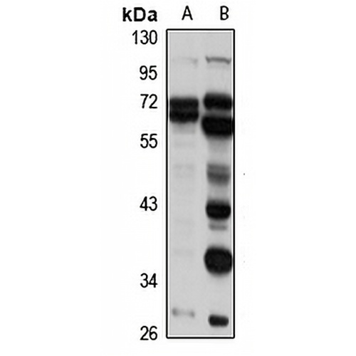 AKR1D1 Rabbit Polyclonal Antibody