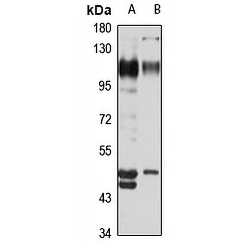 CD166 Rabbit Polyclonal Antibody