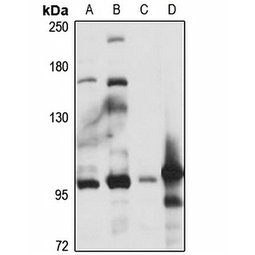 ALDH1L2 Rabbit Polyclonal Antibody