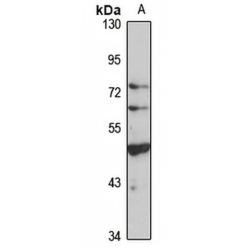 ALDH5A1 Rabbit Polyclonal Antibody
