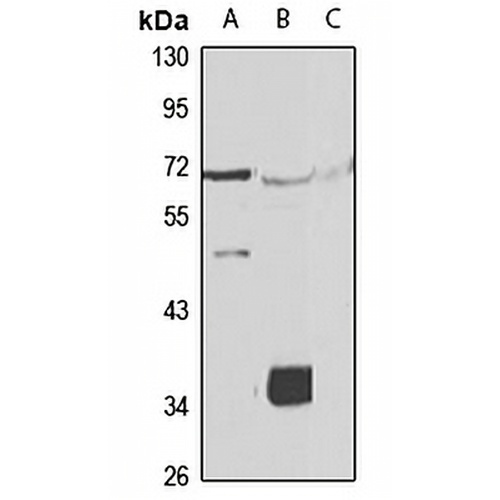 ALG1 Rabbit Polyclonal Antibody