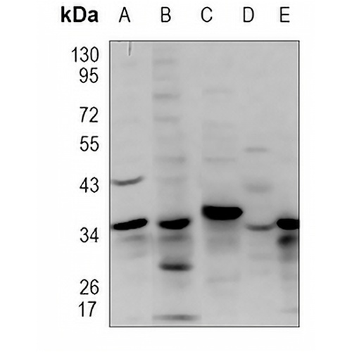 ALG5 Rabbit Polyclonal Antibody