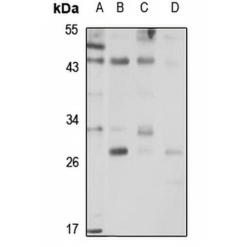 ALKBH6 Rabbit Polyclonal Antibody