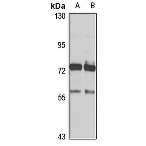 ALKBH8 Rabbit Polyclonal Antibody