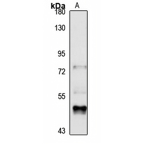 ALPL Rabbit Polyclonal Antibody