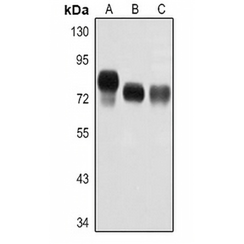 ALPL Rabbit Polyclonal Antibody