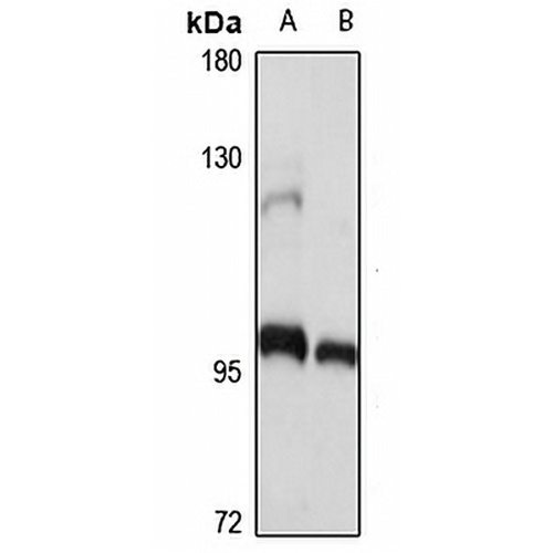 ANAPC2 Rabbit Polyclonal Antibody