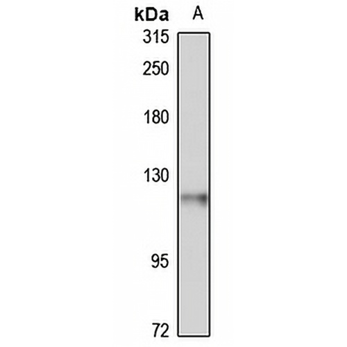 ANKLE2 Rabbit Polyclonal Antibody