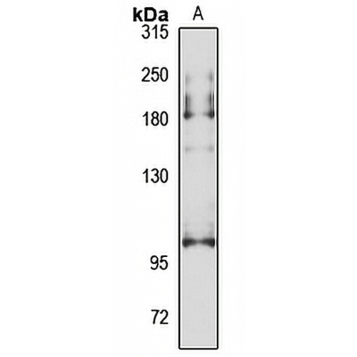 ANO2 Rabbit Polyclonal Antibody