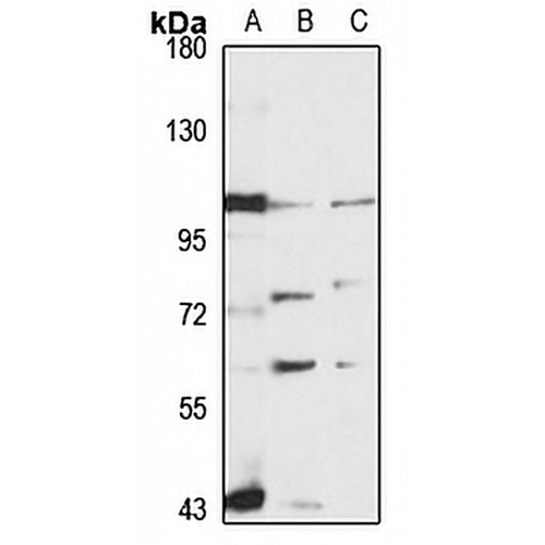 ANO6 Rabbit Polyclonal Antibody
