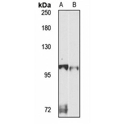 AP1B1 Rabbit Polyclonal Antibody
