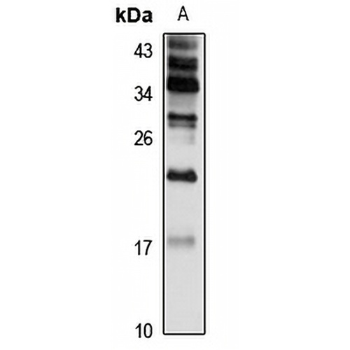 AP1S1 Rabbit Polyclonal Antibody