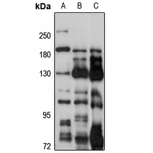 AP3B2 Rabbit Polyclonal Antibody