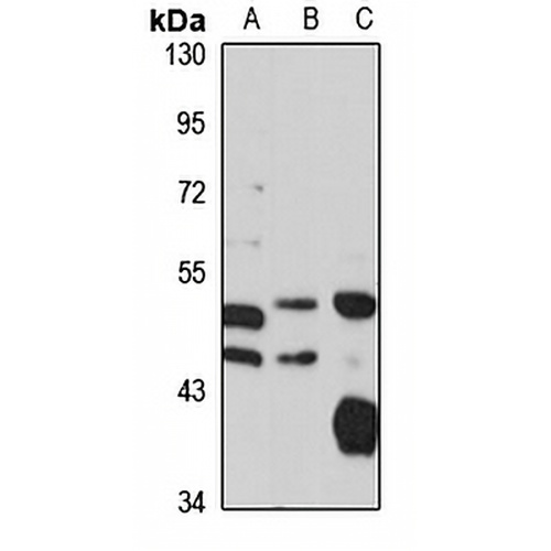 AP3M1 Rabbit Polyclonal Antibody