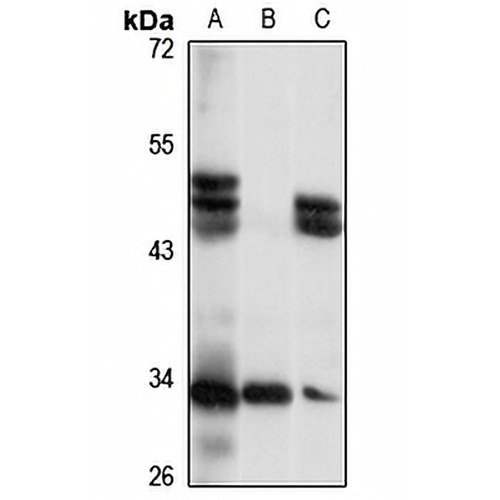 Aph-1 alpha Rabbit Polyclonal Antibody