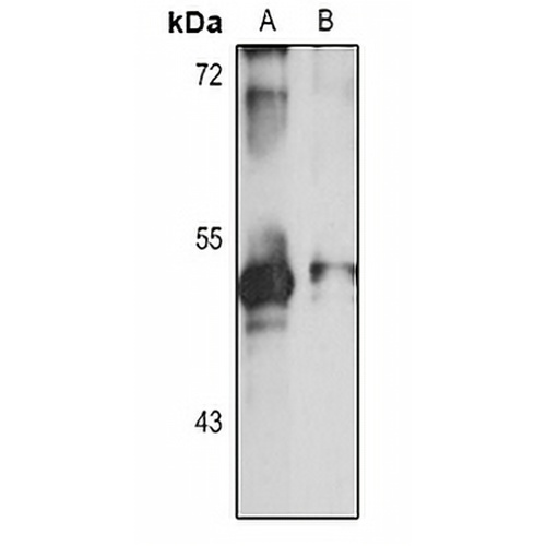 APOBEC3F Rabbit Polyclonal Antibody
