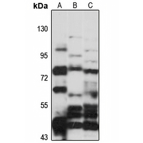 APPL2 Rabbit Polyclonal Antibody