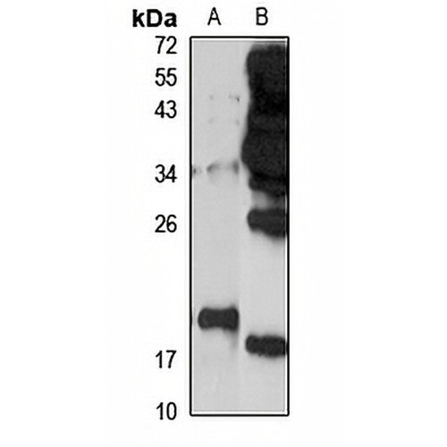 ARL1 Rabbit Polyclonal Antibody