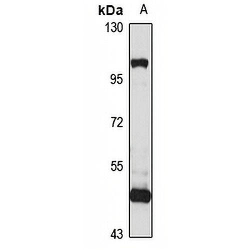 ARL13B Rabbit Polyclonal Antibody