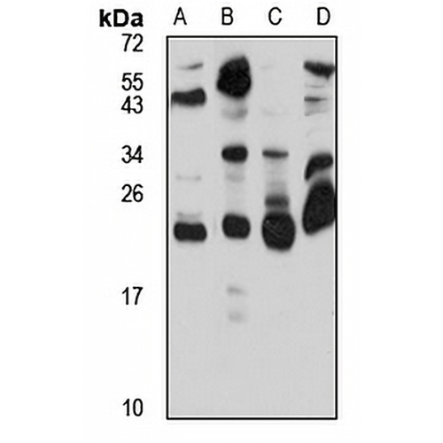 ARL3 Rabbit Polyclonal Antibody