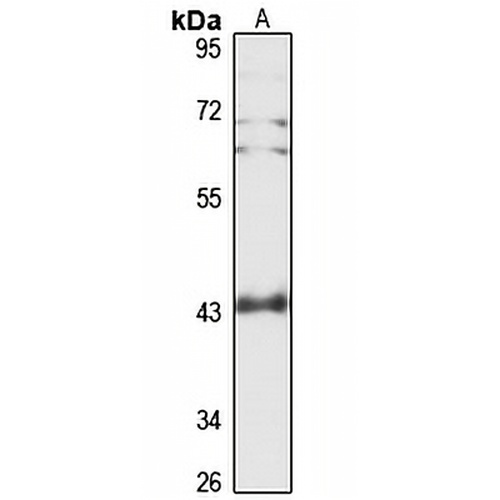 ARPC1A Rabbit Polyclonal Antibody