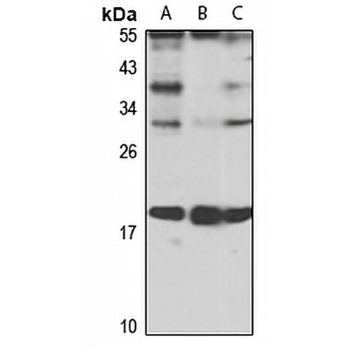 p21-ARC Rabbit Polyclonal Antibody