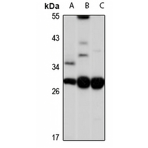ASB-17 Rabbit Polyclonal Antibody