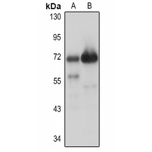ASB-2 Rabbit Polyclonal Antibody