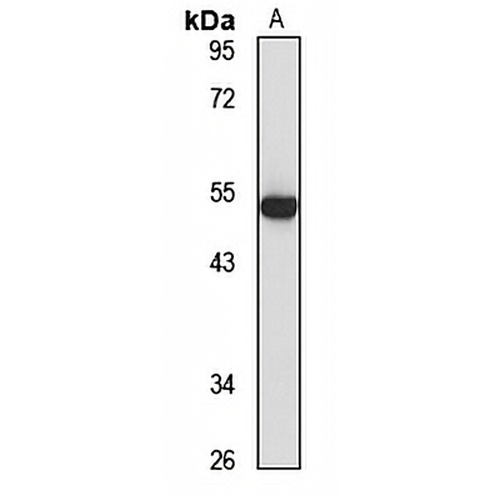ASCC1 Rabbit Polyclonal Antibody