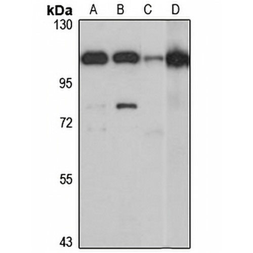 ASCC2 Rabbit Polyclonal Antibody
