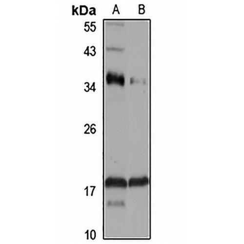 ASCL4 Rabbit Polyclonal Antibody