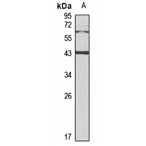 ASGPR2 Rabbit Polyclonal Antibody