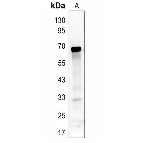 ASH2L Rabbit Polyclonal Antibody
