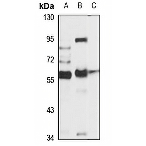 ASIC2 Rabbit Polyclonal Antibody
