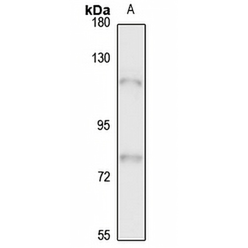 ASPH Rabbit Polyclonal Antibody