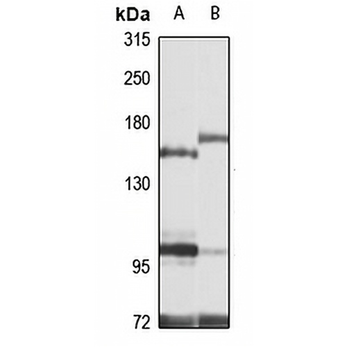 ASXL1 Rabbit Polyclonal Antibody