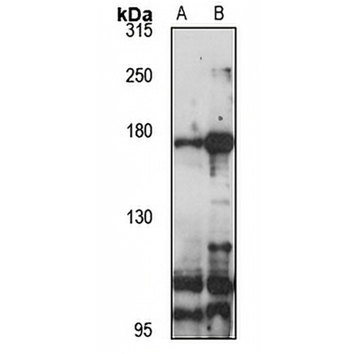 ATP10A Rabbit Polyclonal Antibody