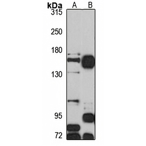 ATP11B Rabbit Polyclonal Antibody