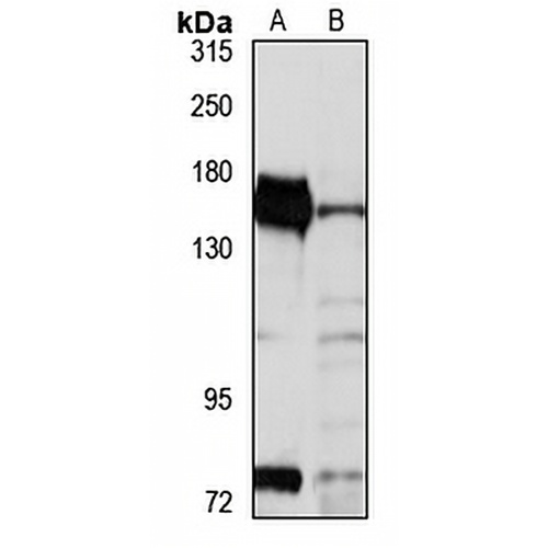 ATP11C Rabbit Polyclonal Antibody