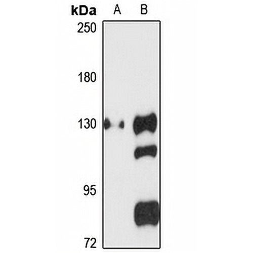 ATP13A1 Rabbit Polyclonal Antibody
