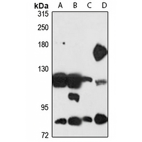 ATP13A2 Rabbit Polyclonal Antibody