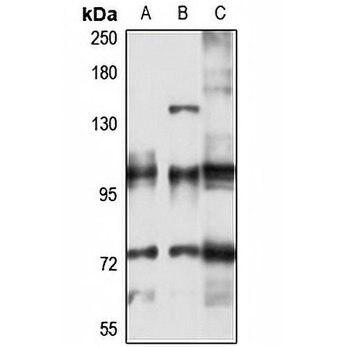 ATP2A3 Rabbit Polyclonal Antibody