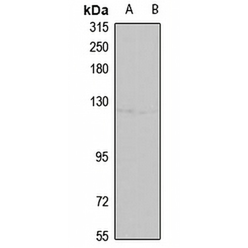 ATP2C1 Rabbit Polyclonal Antibody