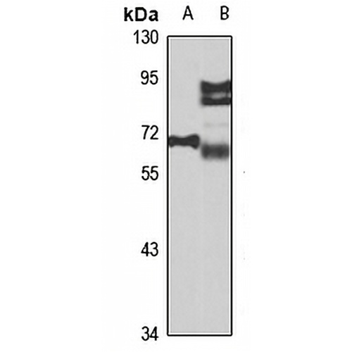 ATP6V0A4 Rabbit Polyclonal Antibody