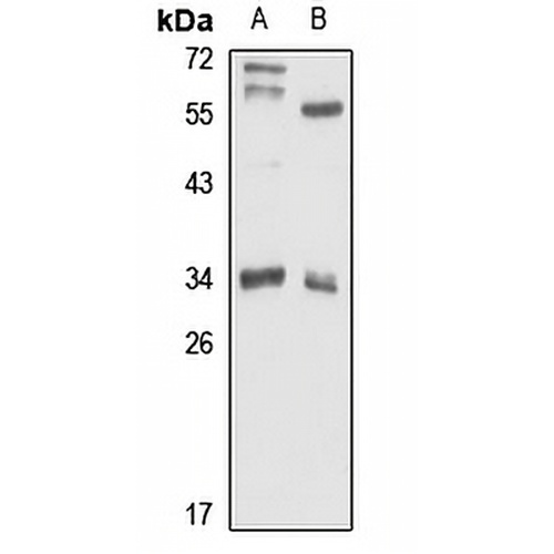 ATP6V1D Rabbit Polyclonal Antibody