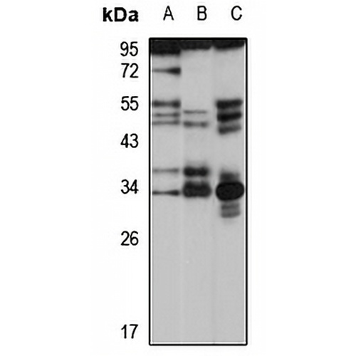 ATP6V1E2 Rabbit Polyclonal Antibody