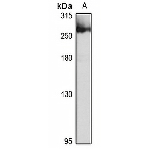 ATR Rabbit Polyclonal Antibody