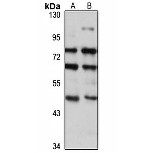 beta 3Gn-T5 Rabbit Polyclonal Antibody