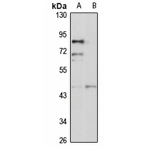 beta 3Gn-T6 Rabbit Polyclonal Antibody